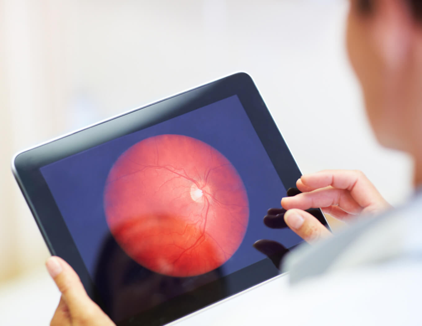 Clinician reviewing a retinal image on a tablet during an eye exam.